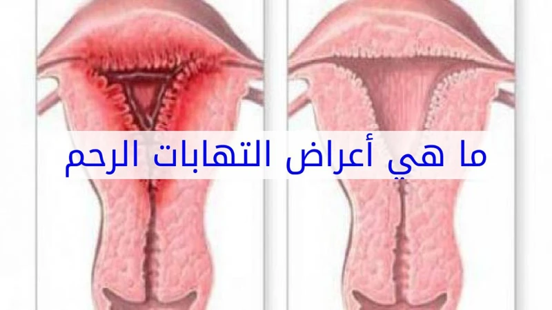 معاني أخرى محتملة لأحلام أعراض إبرة أوزمبك